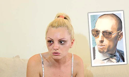 Alexandra Stan a fost bătută măr, pe 15 iunie 2013, de fostul ei impresar și iubit, Marcel Prodan jpeg