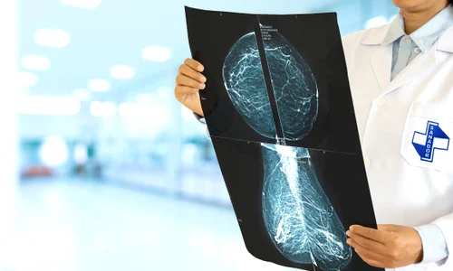 1 investigatii mamare jpg jpeg