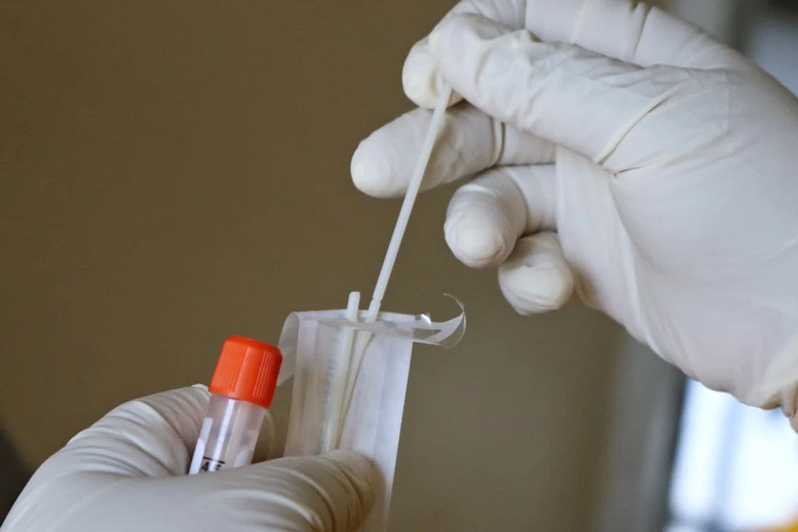 
    Testele antigen nu se mai găsesc în farmaciiFOTO: Unsplash.com  