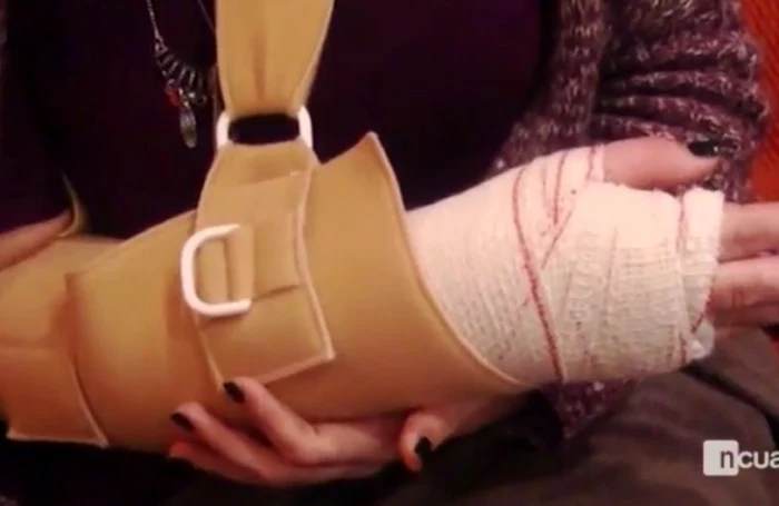 Aşa arată mâna tinerei lovite de mingea trimisă de Messifoto: capătură Cuatro