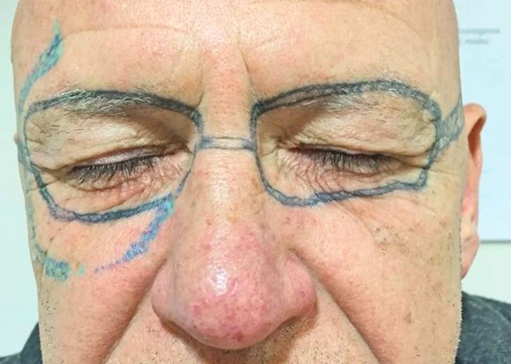 Ochelarii permanenţi, noul trend în Marea BritanieFoto Arhivă Personală