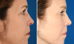 susan dileo business insider webp