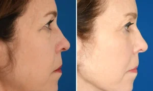 susan dileo business insider webp