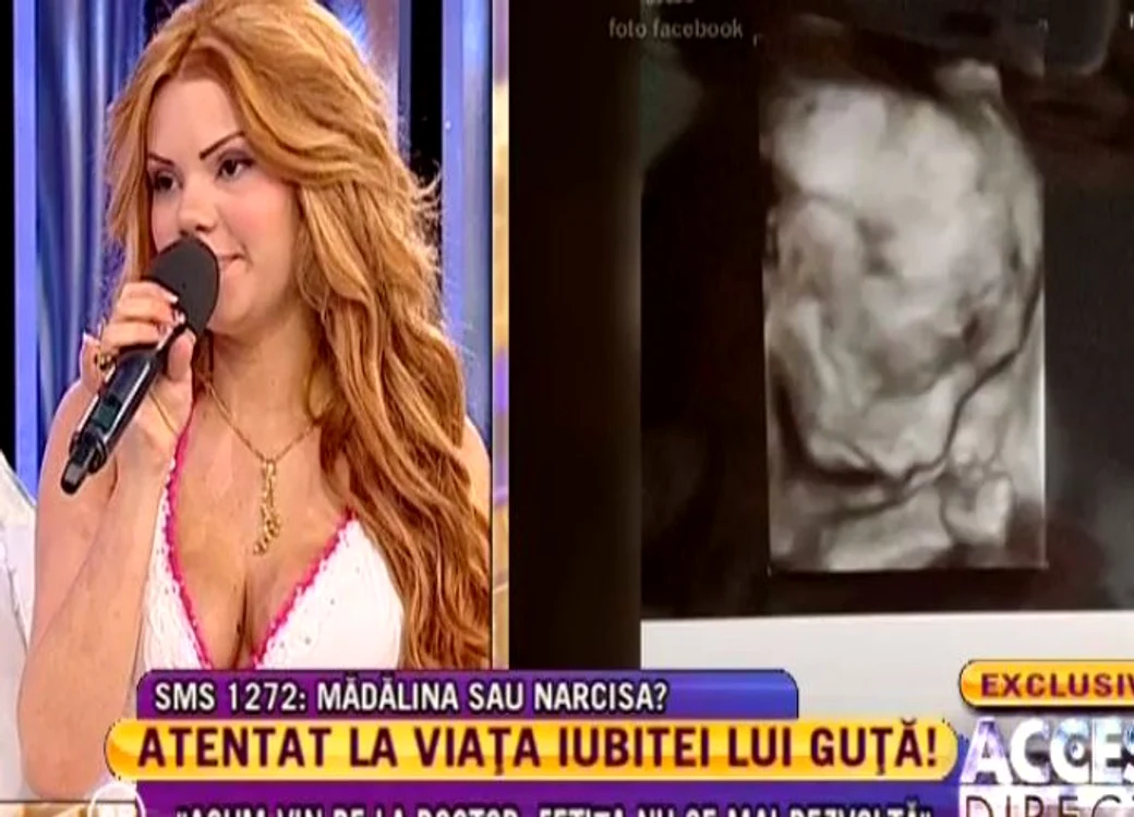 Ecografia lui Beyonce (FOTO ACCES DIRECT)