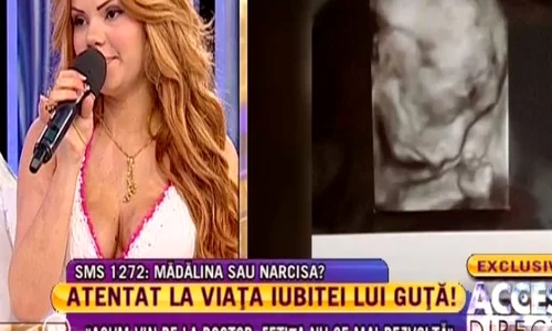 Ecografia lui Beyonce (FOTO ACCES DIRECT) jpeg