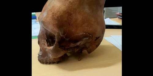 printesa cu craniul alungit  FOTO Muzeul Buzau png