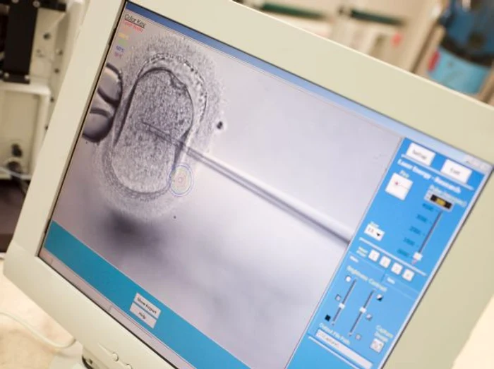Procedurile de fertilizare in vitro, suspectate de favorizarea cancerului ovarian  FOTO Arhivă