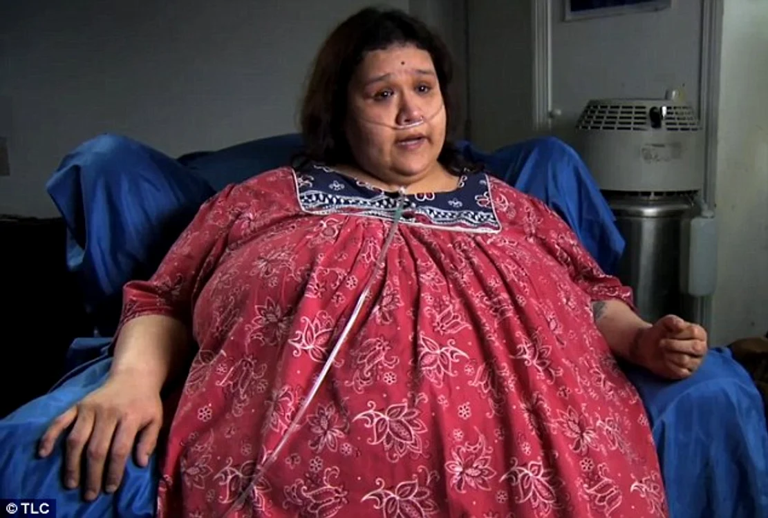 
    Orice mişcare e dureroaă pentru ea  