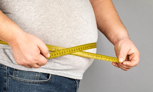 obezitate abdominala jpg