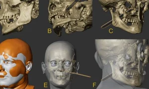 chipul unui vampir reconstruit de oamenii de stiinta barbatul fusese decapitat dupa moarte pentru a nu se intoarce printre cei vii 1044632 jpg