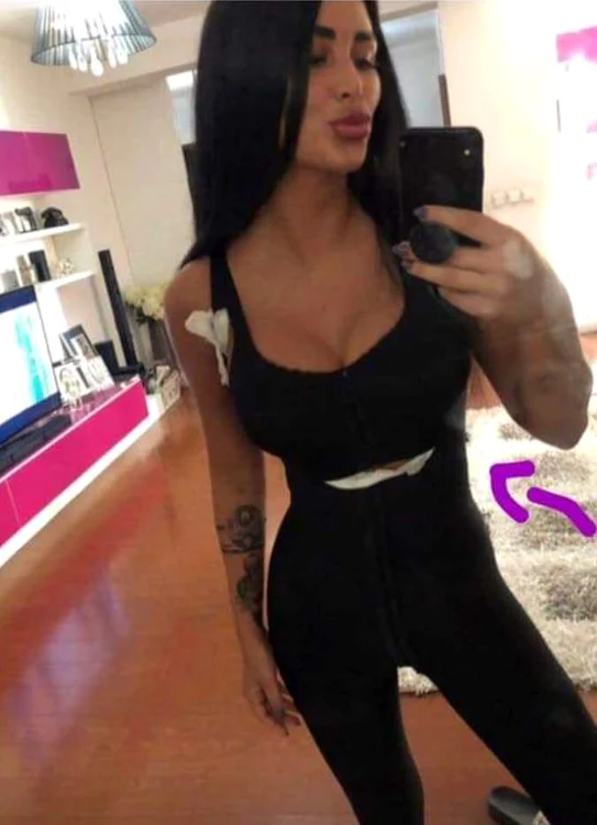 Aşa arată acum Daniela Crudu, după liposculpură