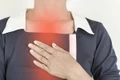 1 refluxul gastric jpg jpeg