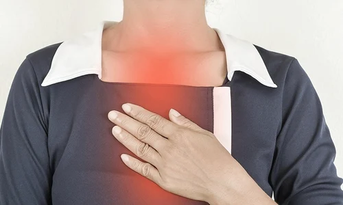 1 refluxul gastric jpg jpeg