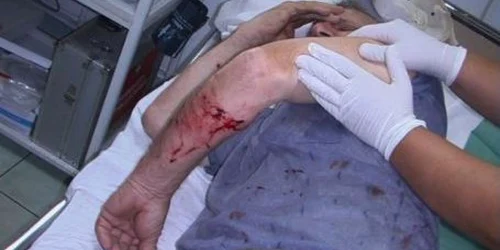 Victima a fost transferată la Spitalul de Neurochirurgie din Iaşi