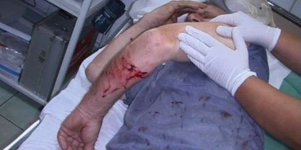 Victima a fost transferată la Spitalul de Neurochirurgie din Iaşi