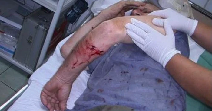 Victima a fost transferată la Spitalul de Neurochirurgie din Iaşi