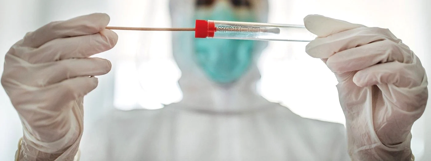 Prețul testelor anti Covid-19 RT-PCR este redus la jumătate