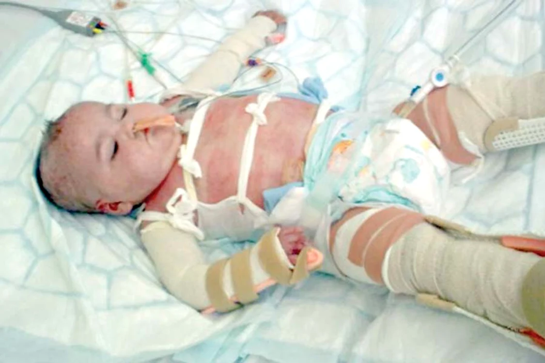 Fetiţa se joacă  fericită, sperând  ca în doi ani să  fie ca un copil  normal