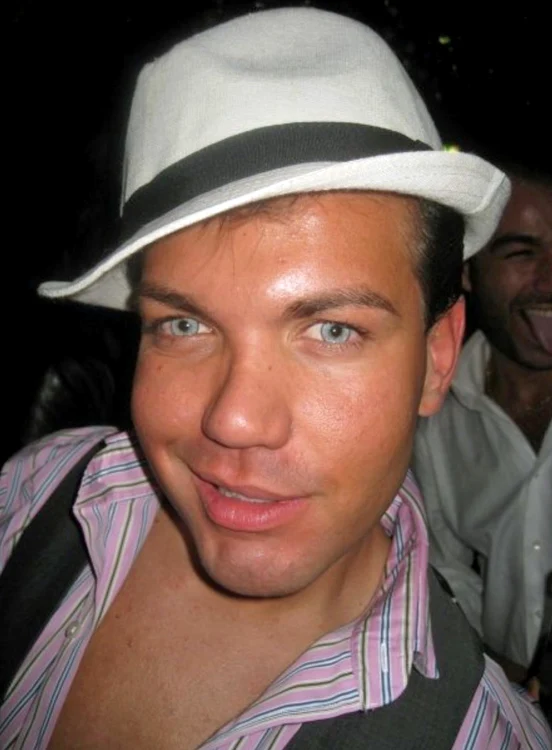 17 rodrigo alves inainte de operatiile estetice jpg jpeg