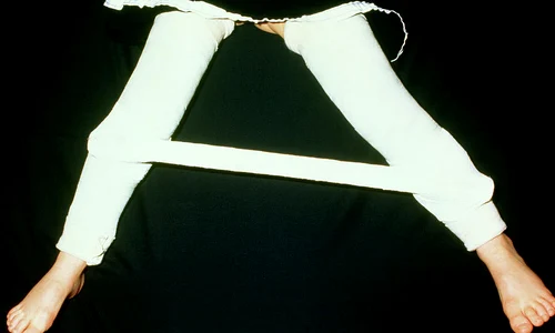 1 boala perthes jpg jpeg