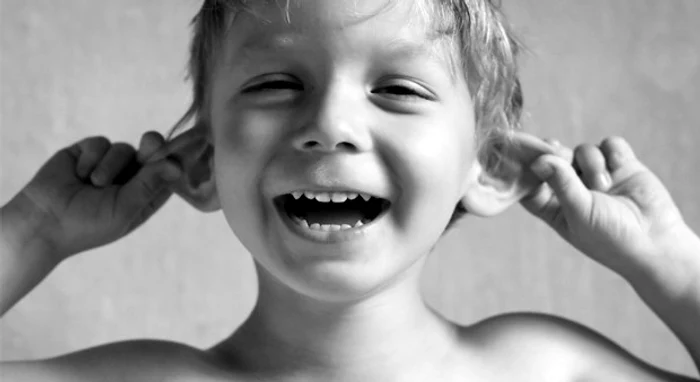 
    Băiatul era batjocorit constant de prieteni din cauza urechilor mariFoto: cosmeticclinic.co.za  