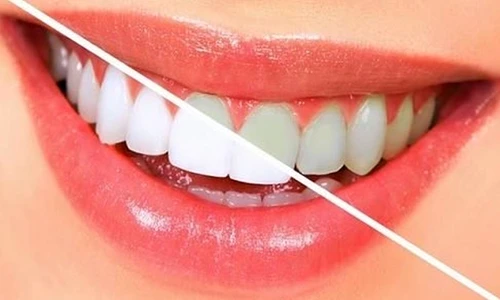 1 77244 original jpg jpeg