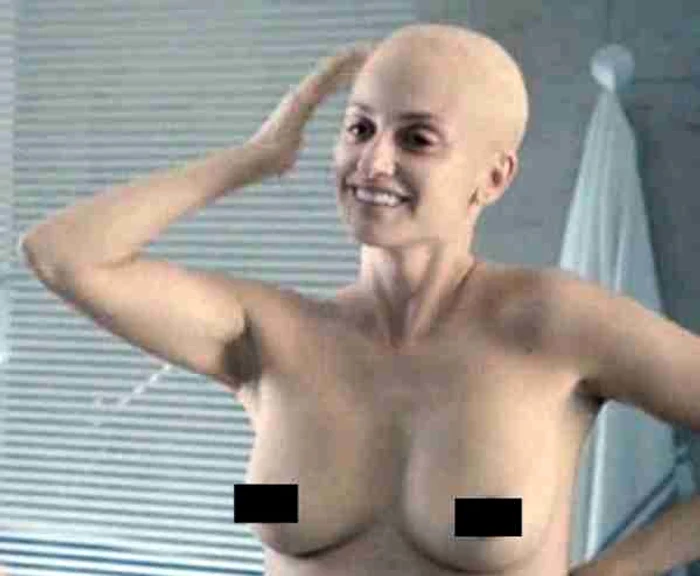 Actrița a vrut să evidențieze toate aspectele acestei boli