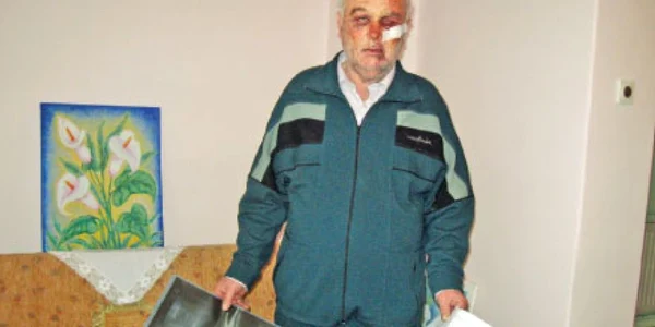 Augustin Togănel a fost bătut cu cruzime de trei bărbaţi  care i-au pătruns în locuinţă