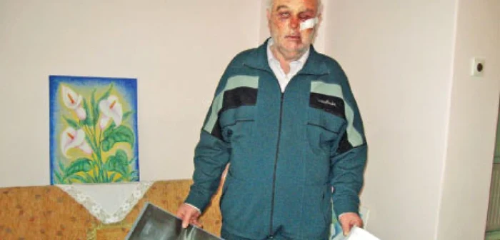 Augustin Togănel a fost bătut cu cruzime de trei bărbaţi care i-au pătruns în locuinţă