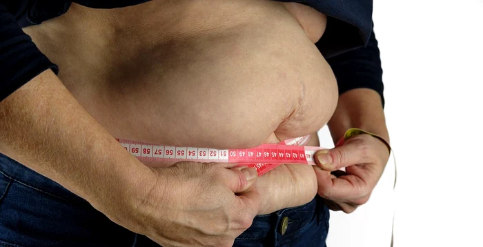 Persoanele obeze, predispuse la sindrom metabolic FOTO: Pixibay