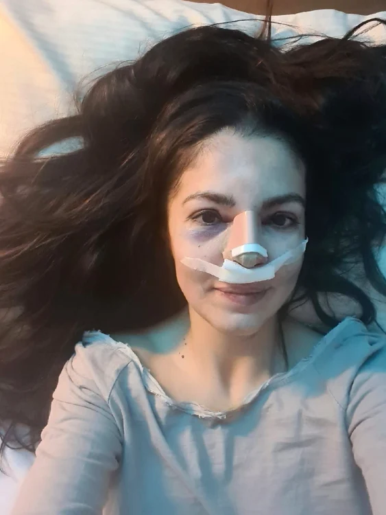 2 cristina joia operata la nas jpg jpeg