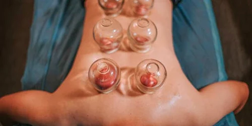 Masaj cu ventuze jpg