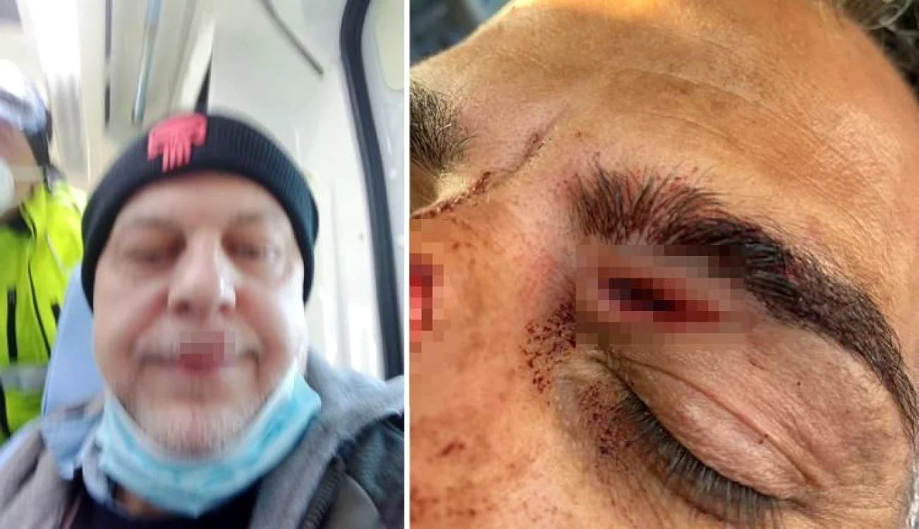 De unul singur, românul în vârstă de 21 de ani i-a bătut pe cei patru poliţişti. FOTO ADN Kronos