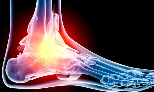 1 77720 original jpg jpeg