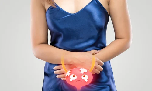 incontinenta urinara jpg