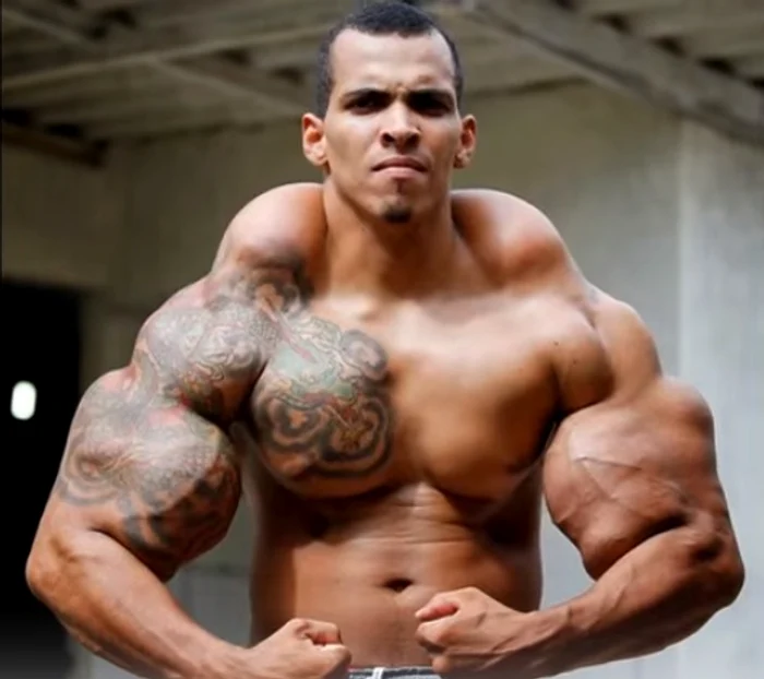 Romario devenise dependent de injectarea intra-musculară