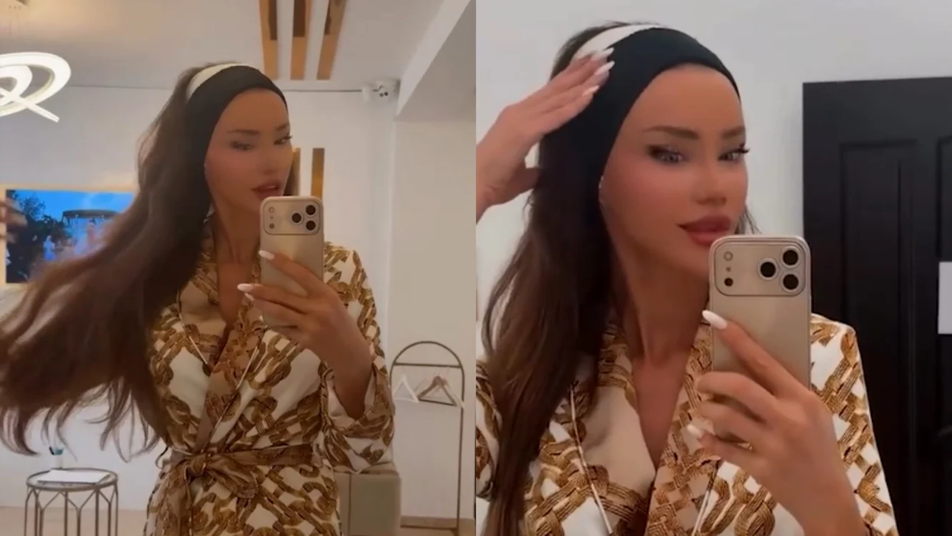 Bianca Drăgușanu, după intervenția de otoplastie. Foto: social media