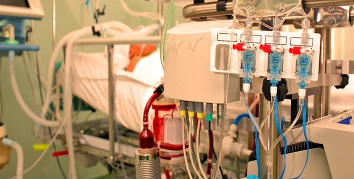 Așa arată un mecanism ECMO  FOTO nurse24.it