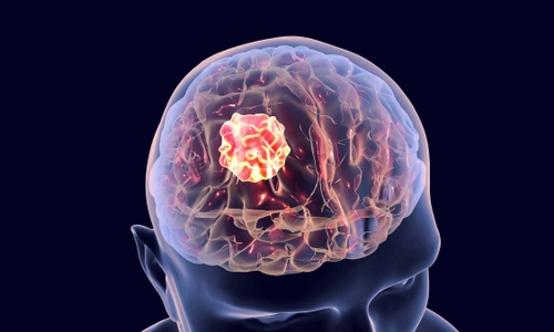 shutterstock 658407514 jpg