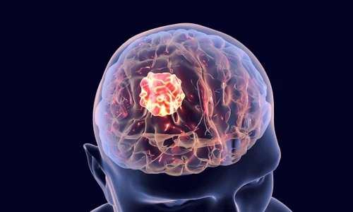 shutterstock 658407514 jpg