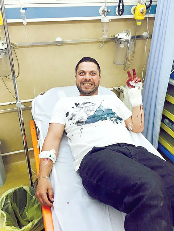 În finala emisiunii “Ferma Vedetelor” (PRO TV), din neatenţie, Augustin şi-a secţionat mâna cu toporul, ajungând pe patul de spital