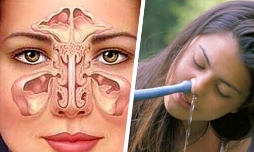 1 74991 original jpg jpeg