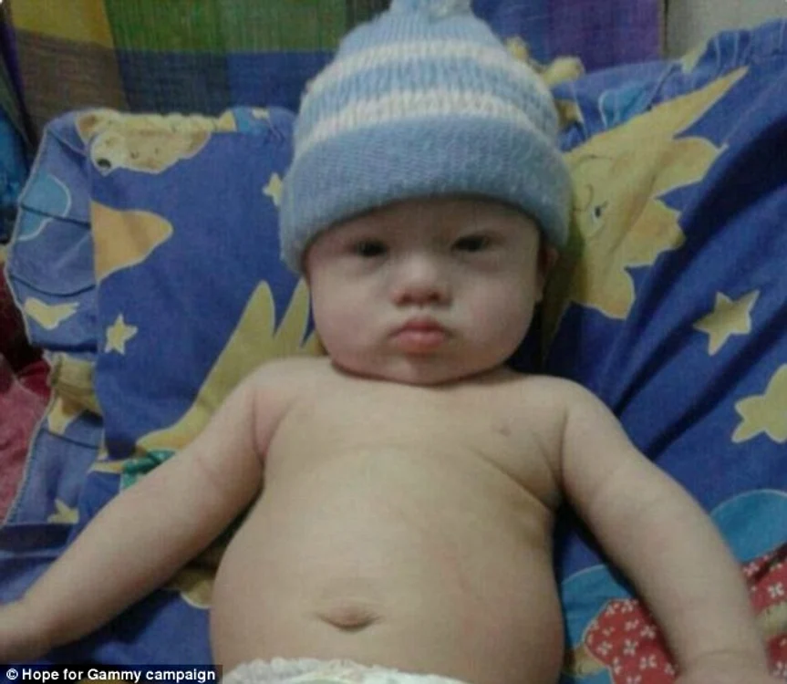 
    Gammy a fost abandonat de părinţii lui pentru că avea sindromul Down  
