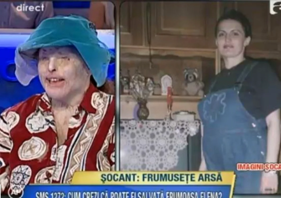 Elena a fost desfigurată FOTO: Acces Direct