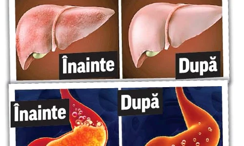 13 inainte dupa jpeg