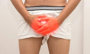vasectomie jpg