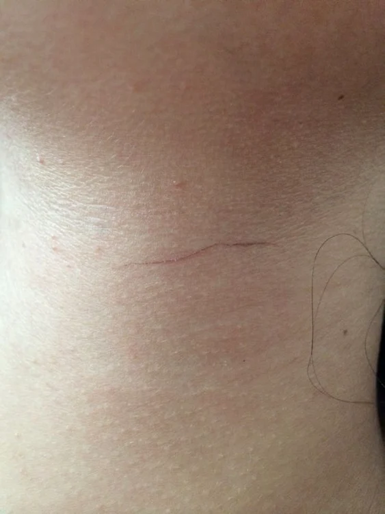 Este vânătă pe sâni