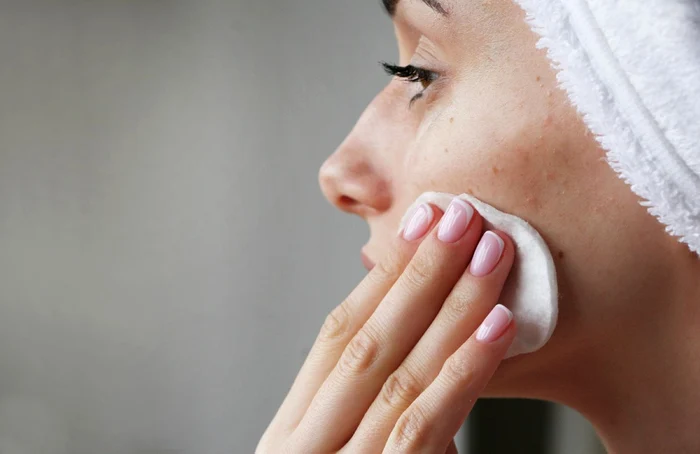 Putem scăpa ușor de acnee cu ajutorul acestor metode
