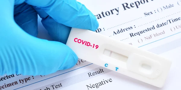 Test covid - coronavirus / FOTO Shutterstock