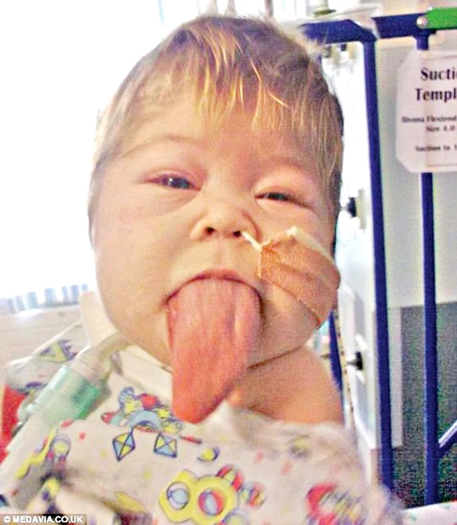 Olivia Gillies  a fost operată de  trei ori până acum